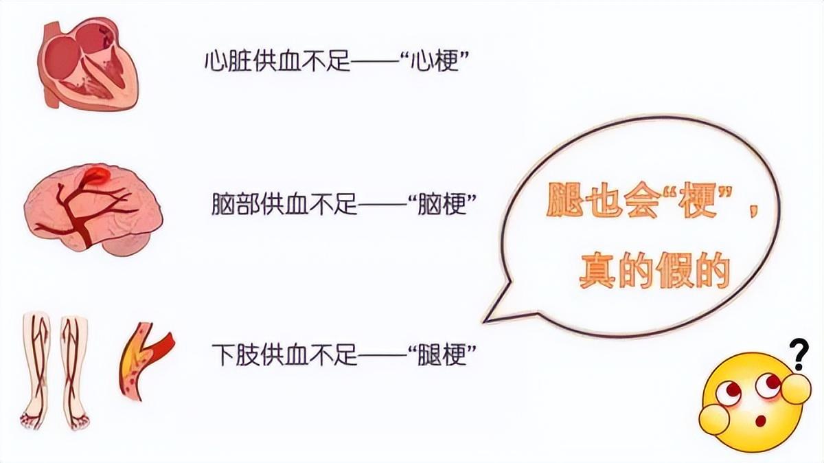 郑州限号措施全面解析，影响、原因与应对策略